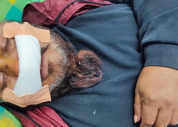रुपन्देहीमा देउवा पक्षबाट पौडेल पक्षका नेता कुटिए